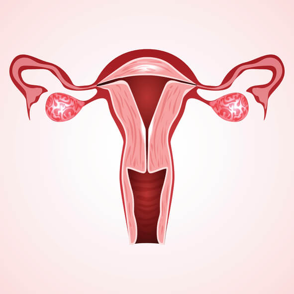 ovarian-cyst